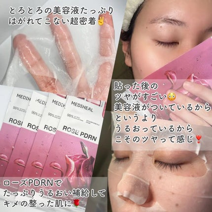 ローゼPDRNエッセンシャルマスクヘルシーグロウ/MEDIHEAL/シートマスク・パックを使ったクチコミ(2枚目)