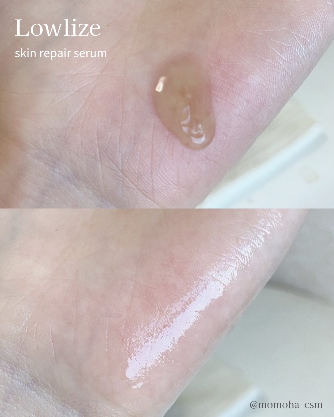 スキンRPセラム/Lowlize/美容液を使ったクチコミ（3枚目）