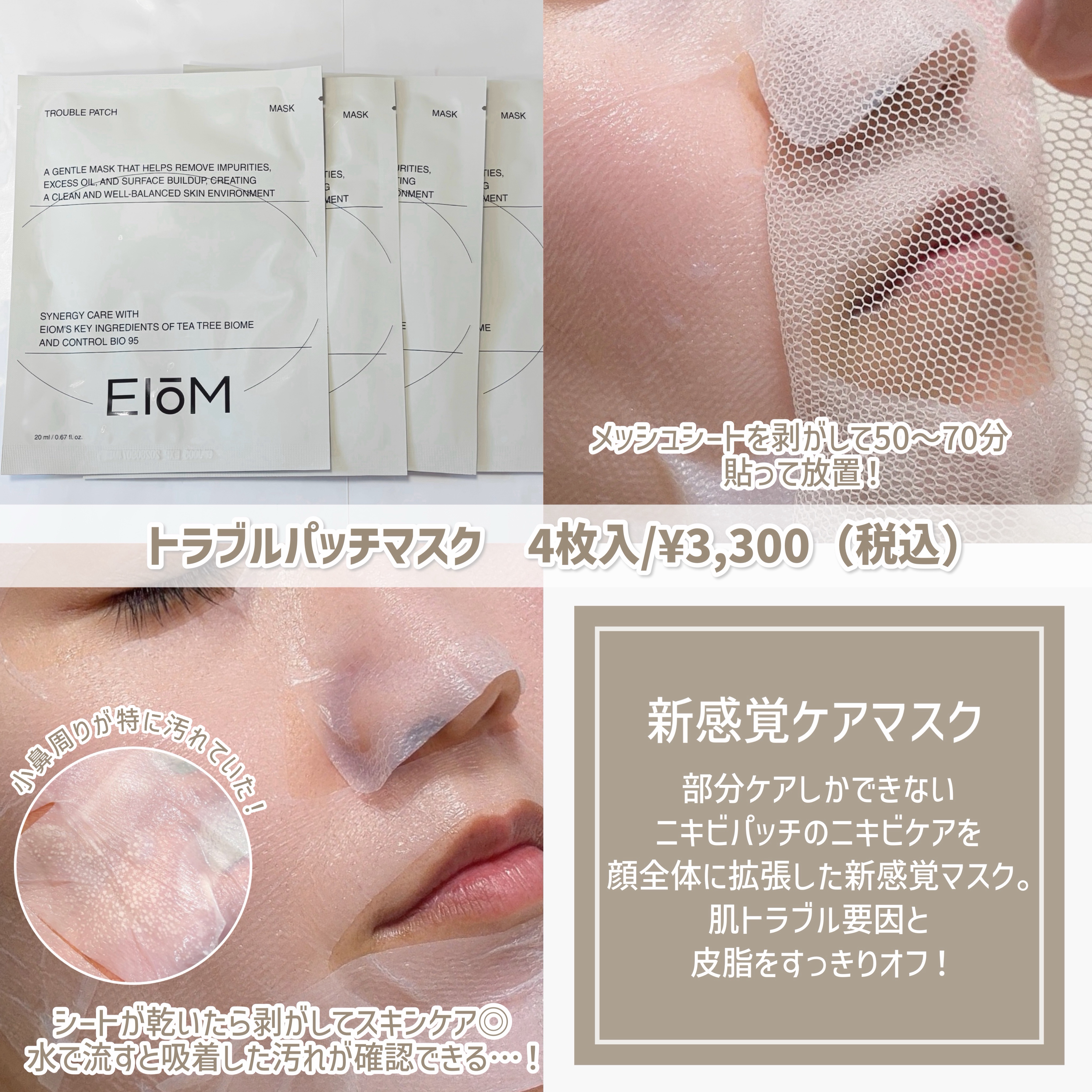トラブルパッチマスク/EIOM/その他スキンケアを使ったクチコミ（3枚目）