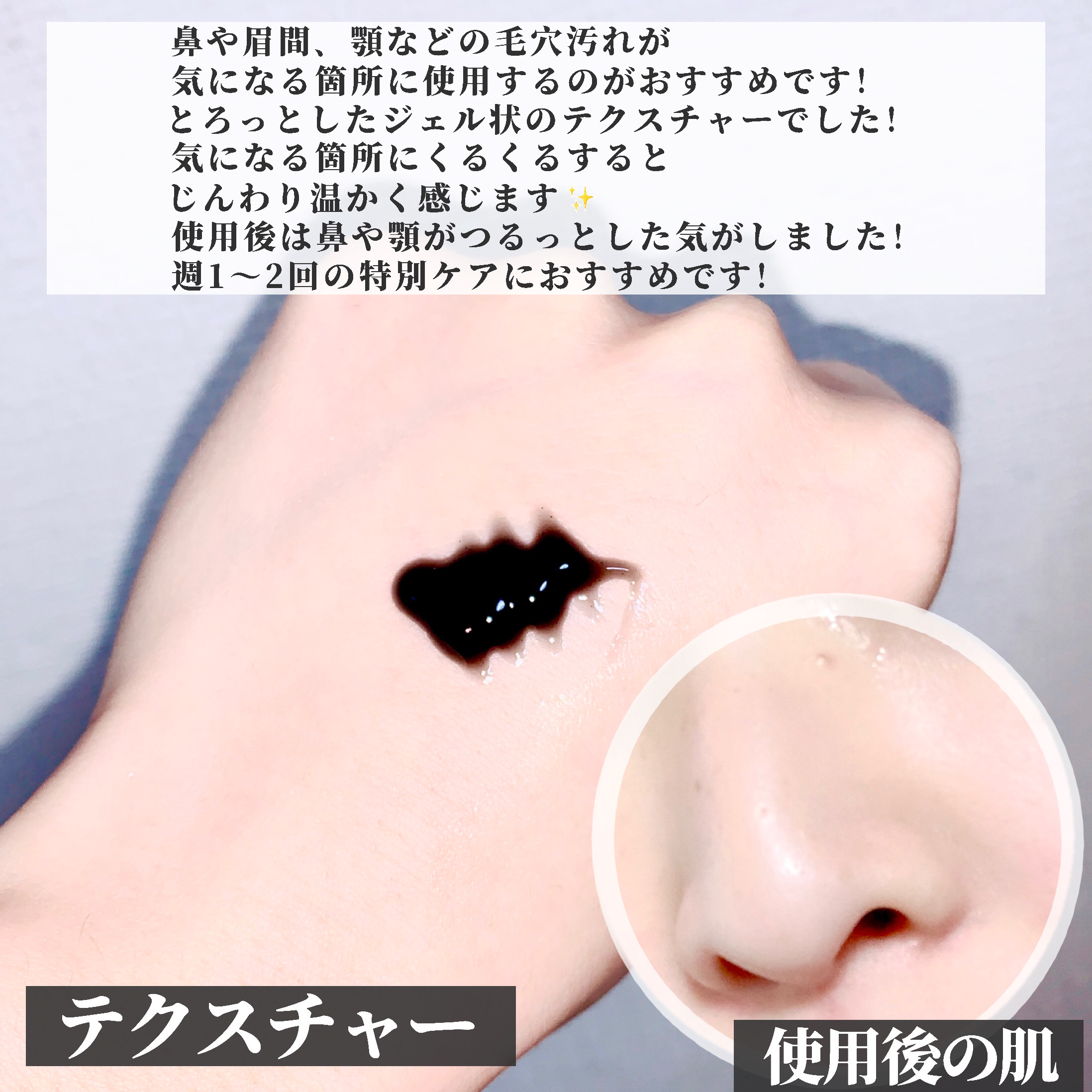 ｓｋｉｍｍｅ　  ヒートブースト　ポアクリア　ジェル洗顔/クラシエ/その他洗顔料を使ったクチコミ（3枚目）