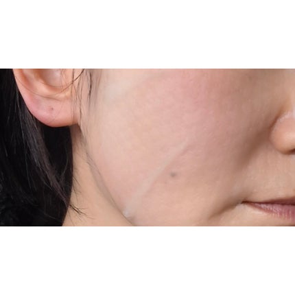 リードルS レチA EXマスク/VT/シートマスク・パックを使ったクチコミ(5枚目)