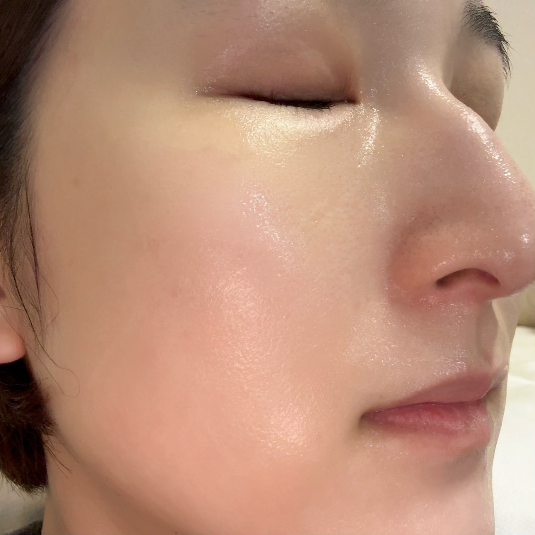 ローゼPDRNエッセンシャルマスクヘルシーグロウ/MEDIHEAL/シートマスク・パックを使ったクチコミ（3枚目）