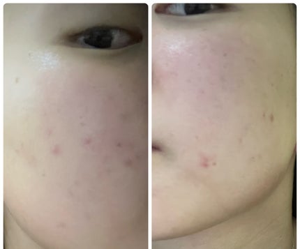 ぽむ on LIPS 「1枚目 2026.1.21エピデュオ 861日目2枚目 202..」(3枚目)