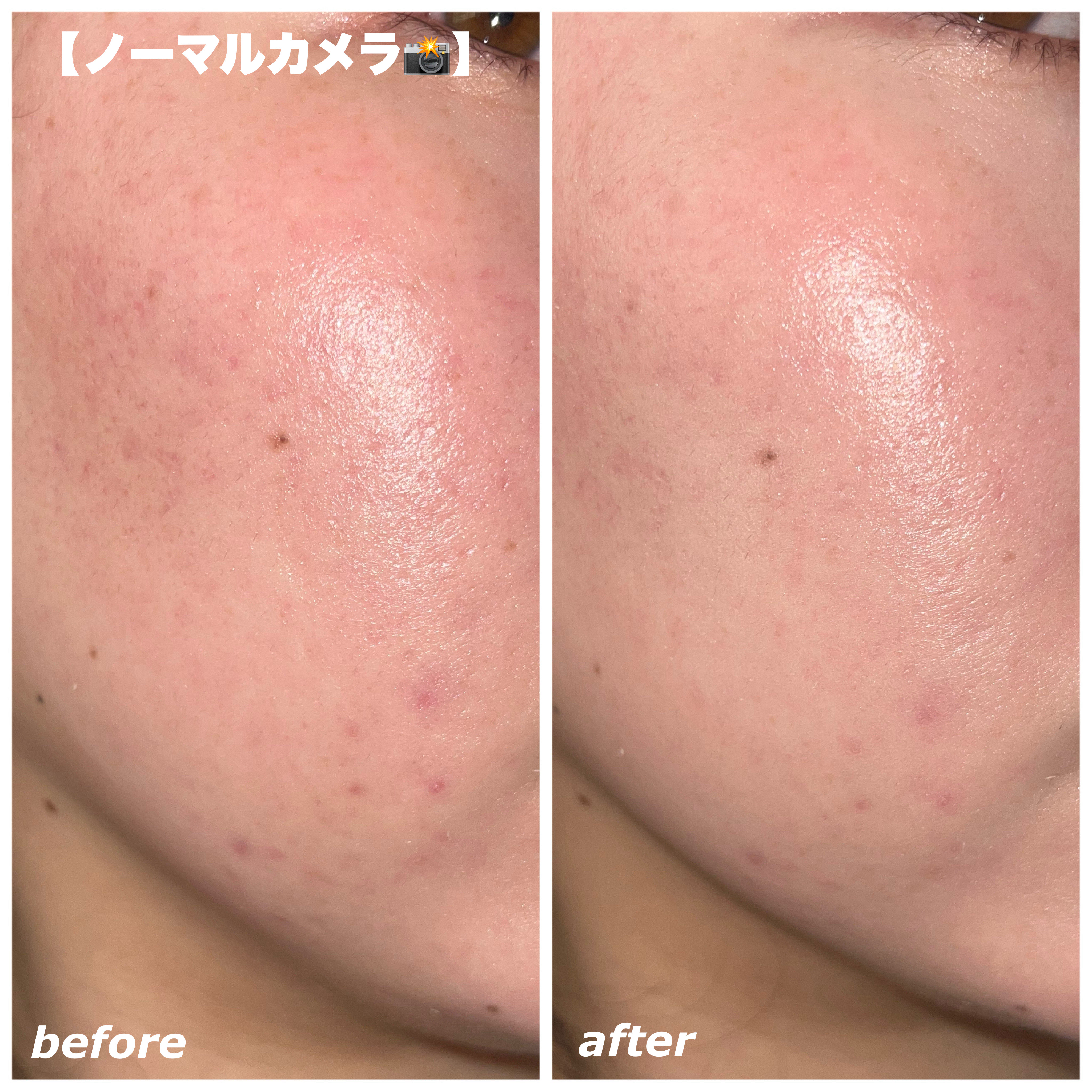 エッグスリックファンデーション/EITHER＆/リキッドファンデーションを使ったクチコミ（3枚目）