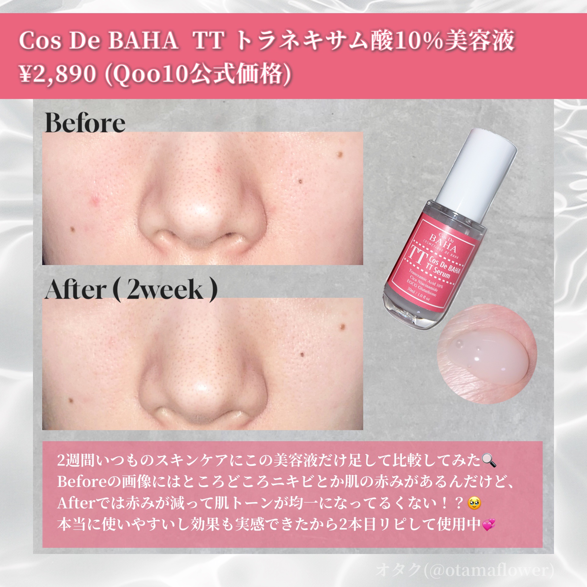 TTトラネキサム酸10％美容液/コスデバハ/美容液を使ったクチコミ（3枚目）