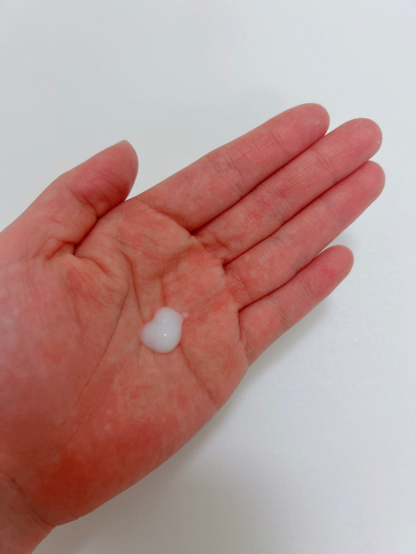 New Trial set/ステムボーテ/トライアルキットを使ったクチコミ(2枚目)