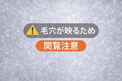 リードルショット700/VT/美容液を使ったクチコミ(2枚目)