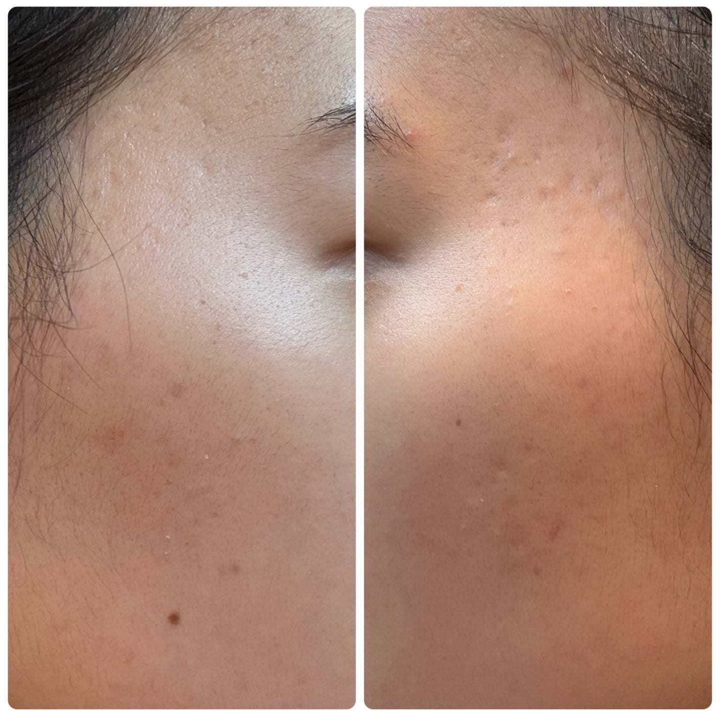 ビタミンCもちプレミアムセラム/アレンシア/美容液を使ったクチコミ(5枚目)