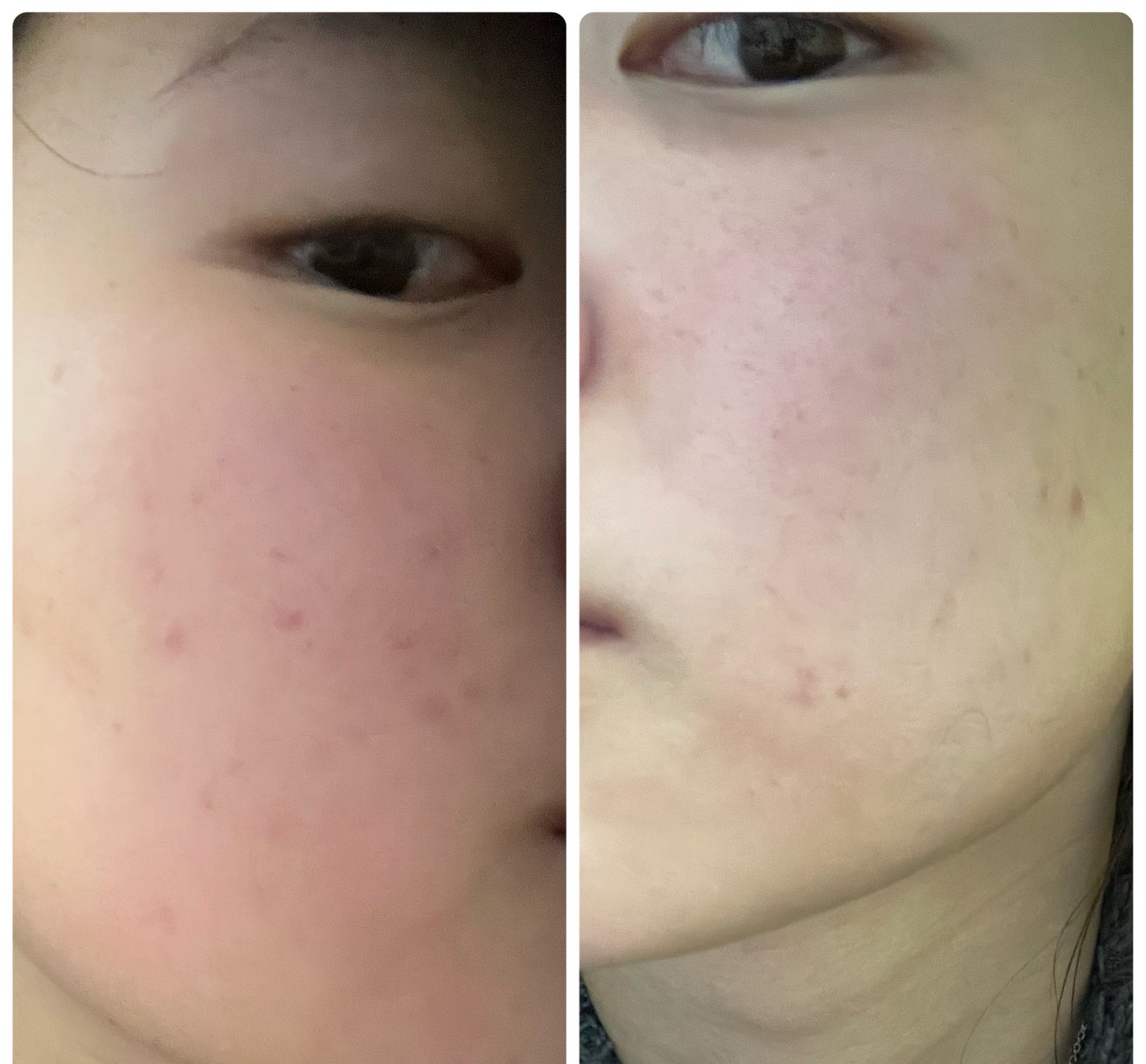 ぽむ on LIPS 「1枚目 2026.1.21エピデュオ 861日目2枚目 202..」(5枚目)