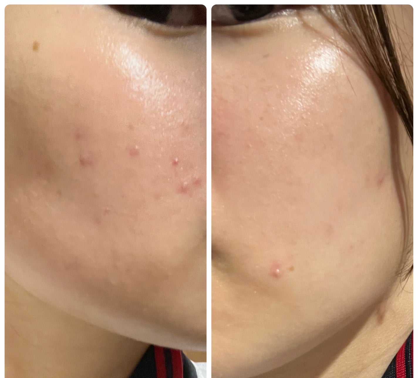 ぽむ on LIPS 「1枚目 2026.1.21エピデュオ 861日目2枚目 202..」(1枚目)