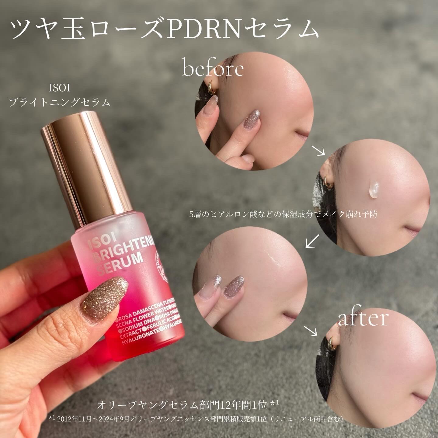 ブレミッシュケアアップ セラム/ISOI/美容液を使ったクチコミ（2枚目）