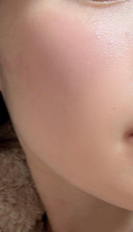 ファーストバランシングトナー/Lowlize/化粧水を使ったクチコミ(2枚目)