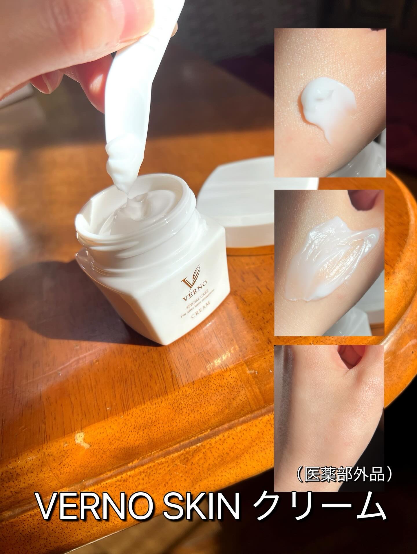 VERNO SKIN クリーム〈医薬部外品〉/VERNO SKIN CARE/フェイスクリームを使ったクチコミ（3枚目）