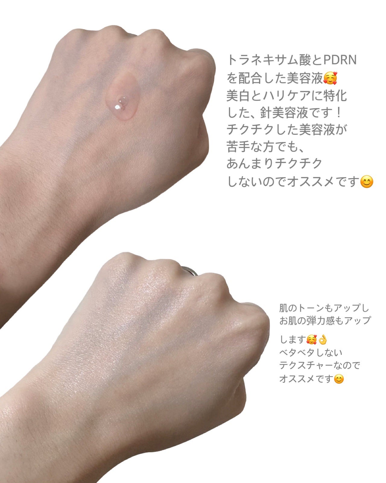 ピンクトーニング™︎ディープインショットアンプル/CNP Laboratory/美容液を使ったクチコミ(2枚目)