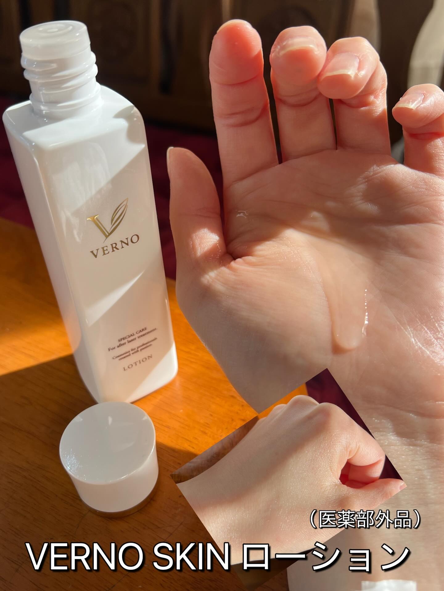 VERNO SKIN クリーム〈医薬部外品〉/VERNO SKIN CARE/フェイスクリームを使ったクチコミ（2枚目）