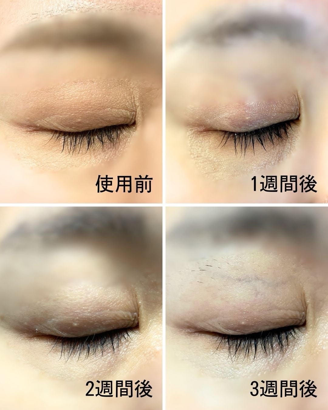 ぼぶ on LIPS 「\リピ率98.6%を1か月使った結果/【正直しかないぼぶの赤裸..」(6枚目)