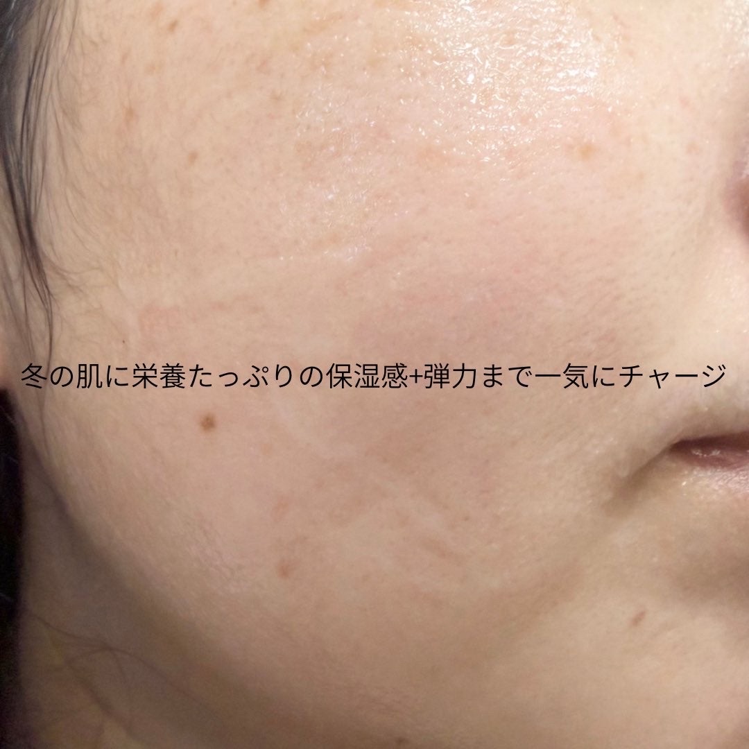 9番 NMNバイオリフトラッピングマスク/numbuzin/シートマスク・パックを使ったクチコミ（3枚目）