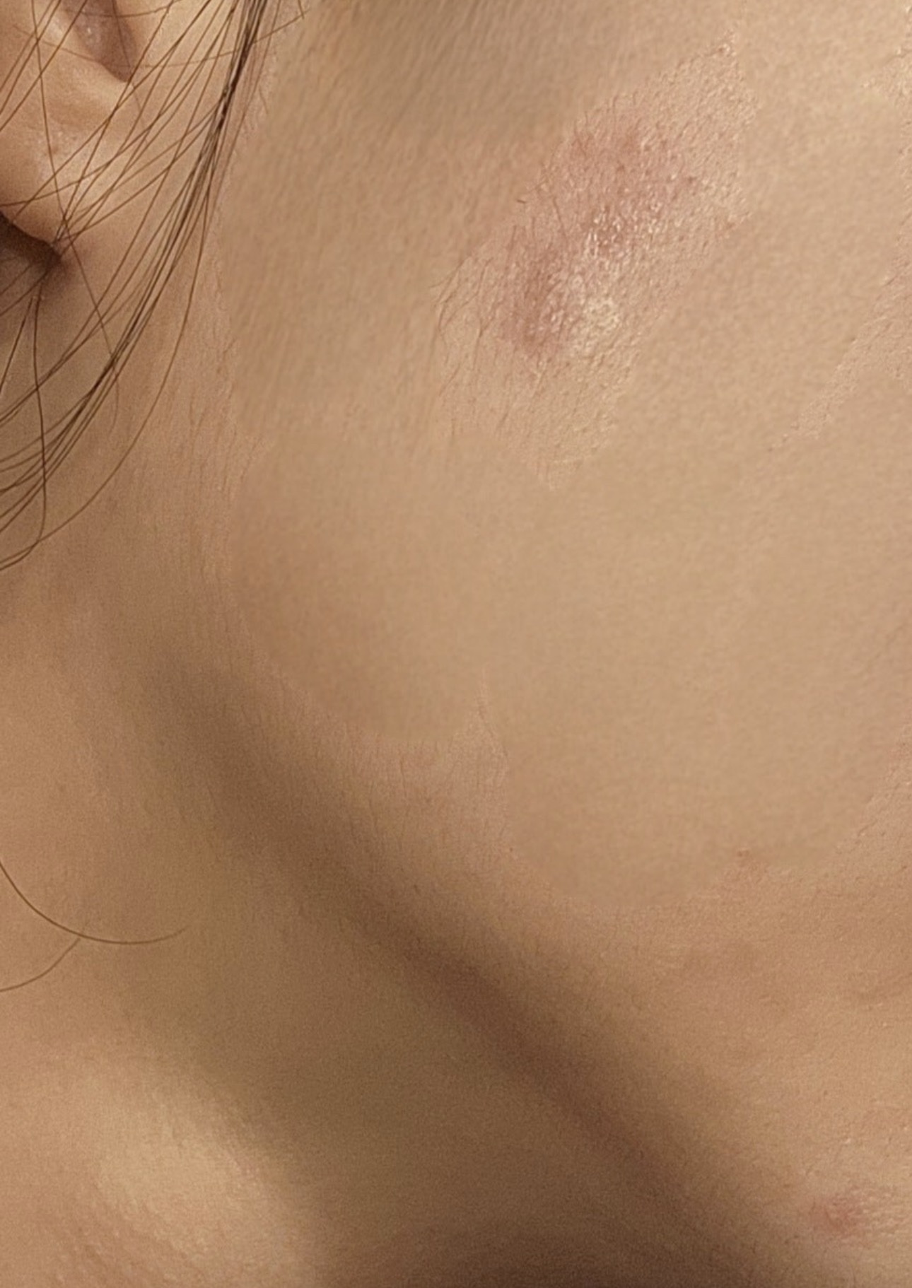 ACマグネシウムパッチ/スノーツープラス/シートマスク・パックを使ったクチコミ（3枚目）