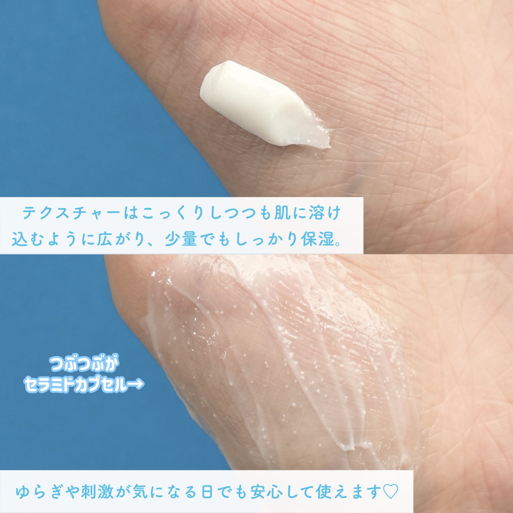 アトバリア365クリーム/AESTURA/フェイスクリームを使ったクチコミ（3枚目）