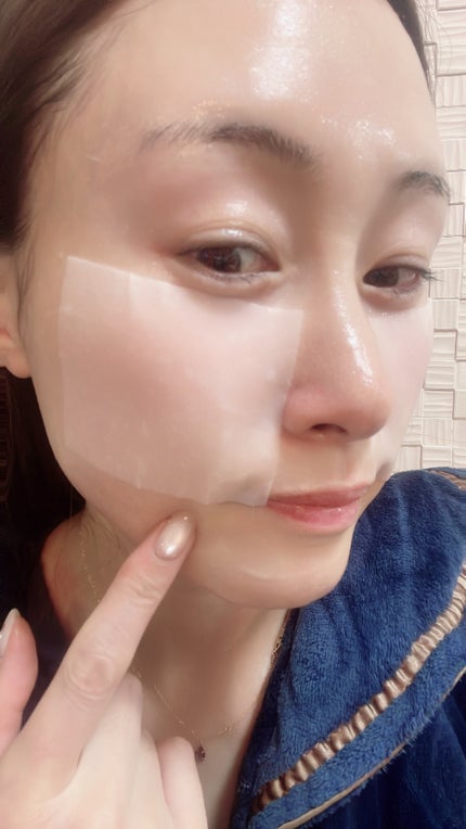 リズム ピコレーザー ニードルスポットパック/RISM/シートマスク・パックを使ったクチコミ(3枚目)