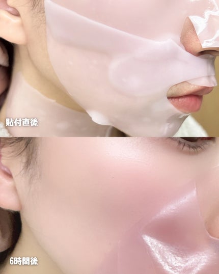 ブラックベリーPDRN リジュショット コラーゲンマスク/Kind Step/シートマスク・パックを使ったクチコミ(3枚目)