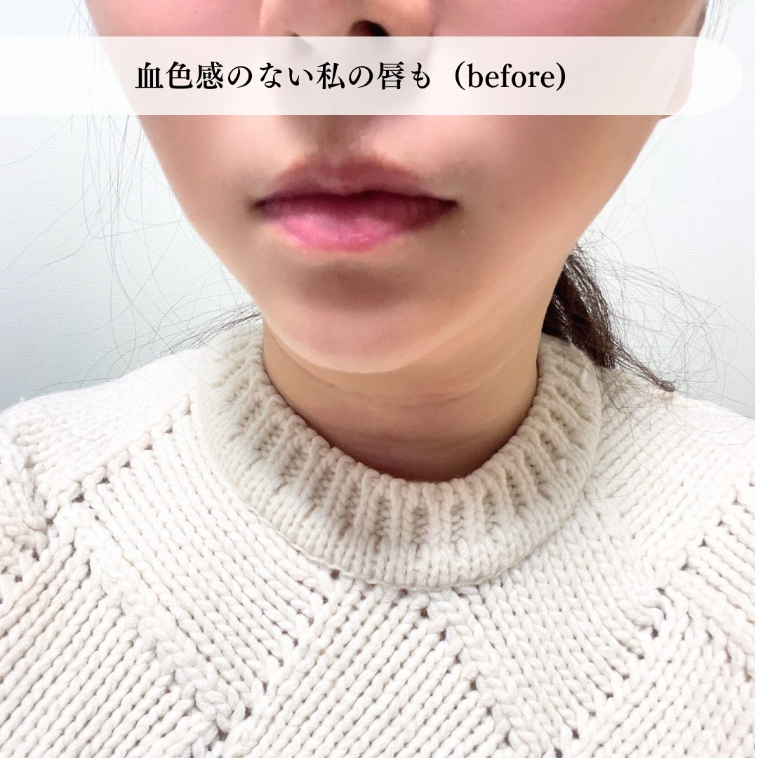 ドトムリッププラスプランパー/keybo/リッププランパーを使ったクチコミ（3枚目）