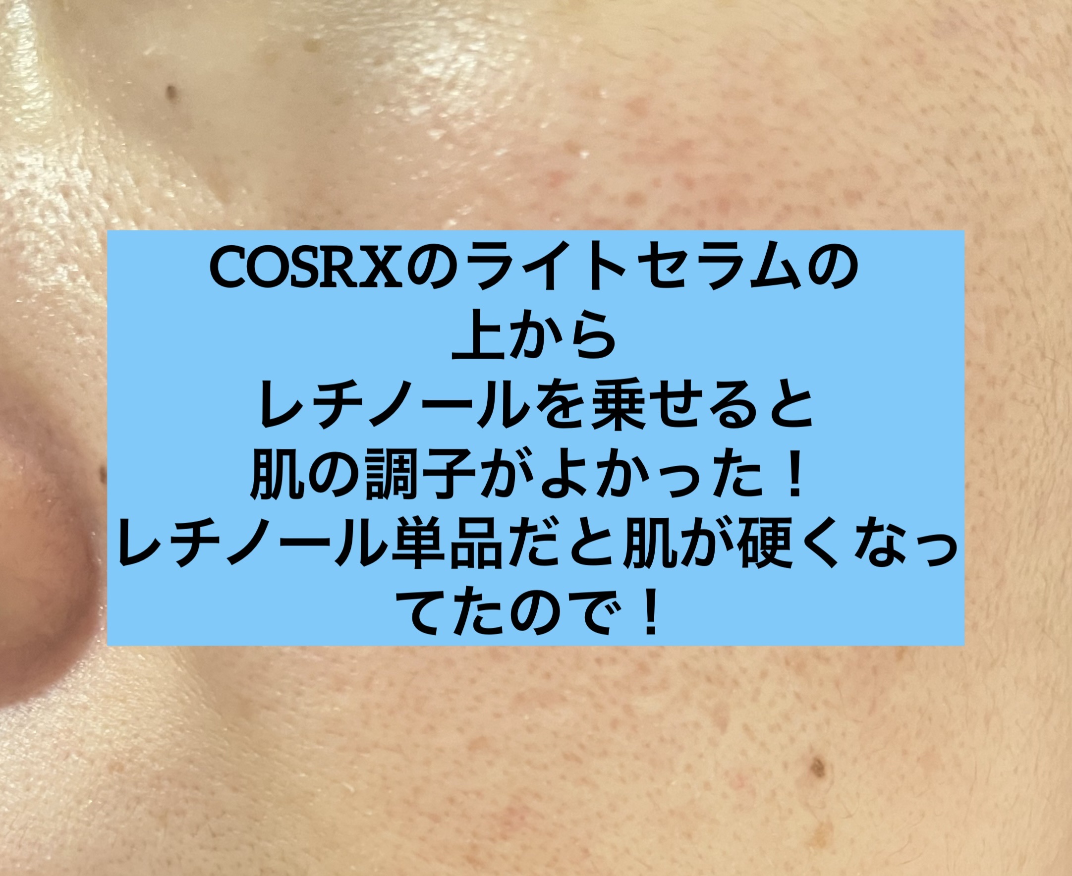 フルフィットプロポリスウルトラライトアンプル /COSRX/美容液を使ったクチコミ（1枚目）