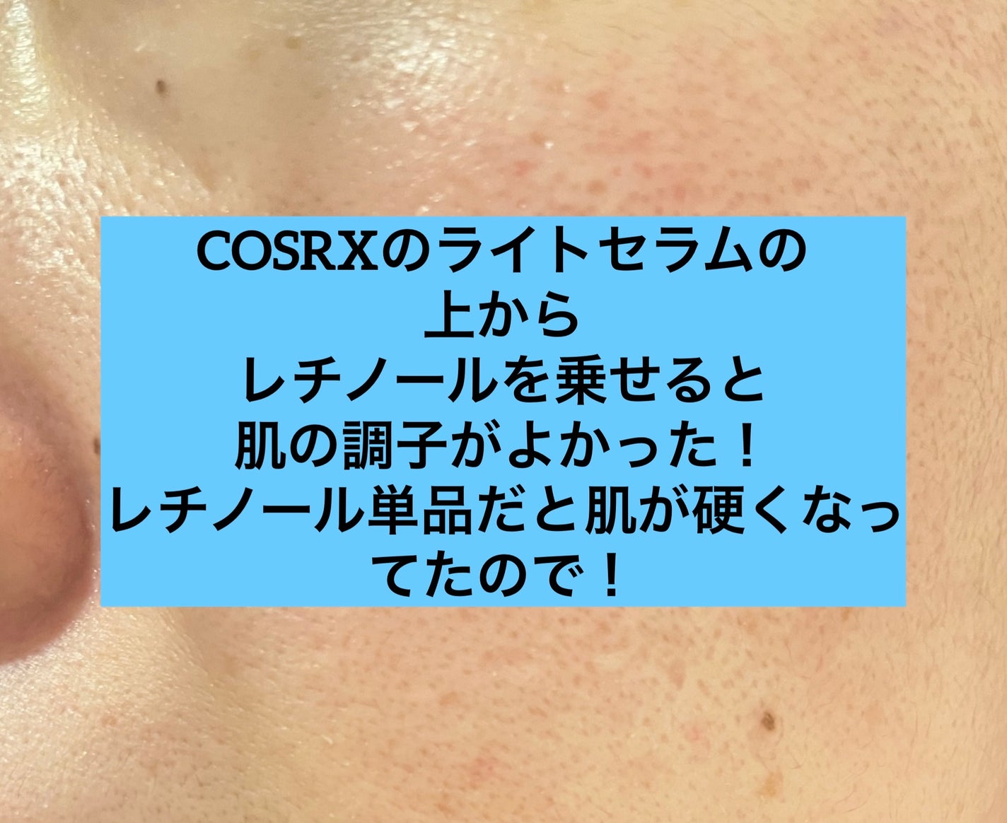 フルフィットプロポリスウルトラライトアンプル /COSRX/美容液を使ったクチコミ(1枚目)