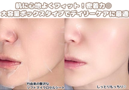 NMNブルースーパーレチノールデイリーターンオーバーマスク/Milk Touch/シートマスク・パックを使ったクチコミ(3枚目)