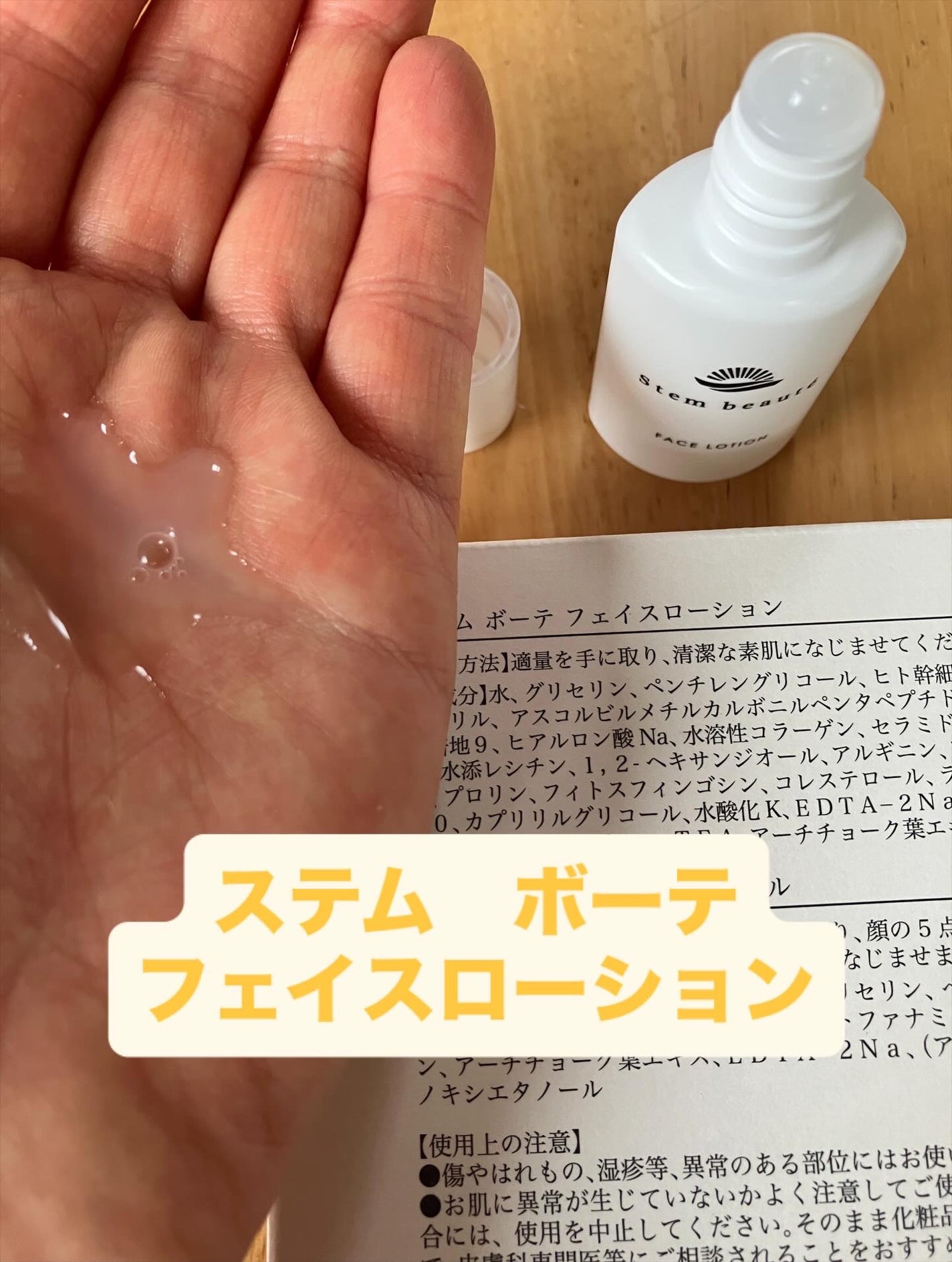 New Trial set/ステムボーテ/トライアルキットを使ったクチコミ(3枚目)