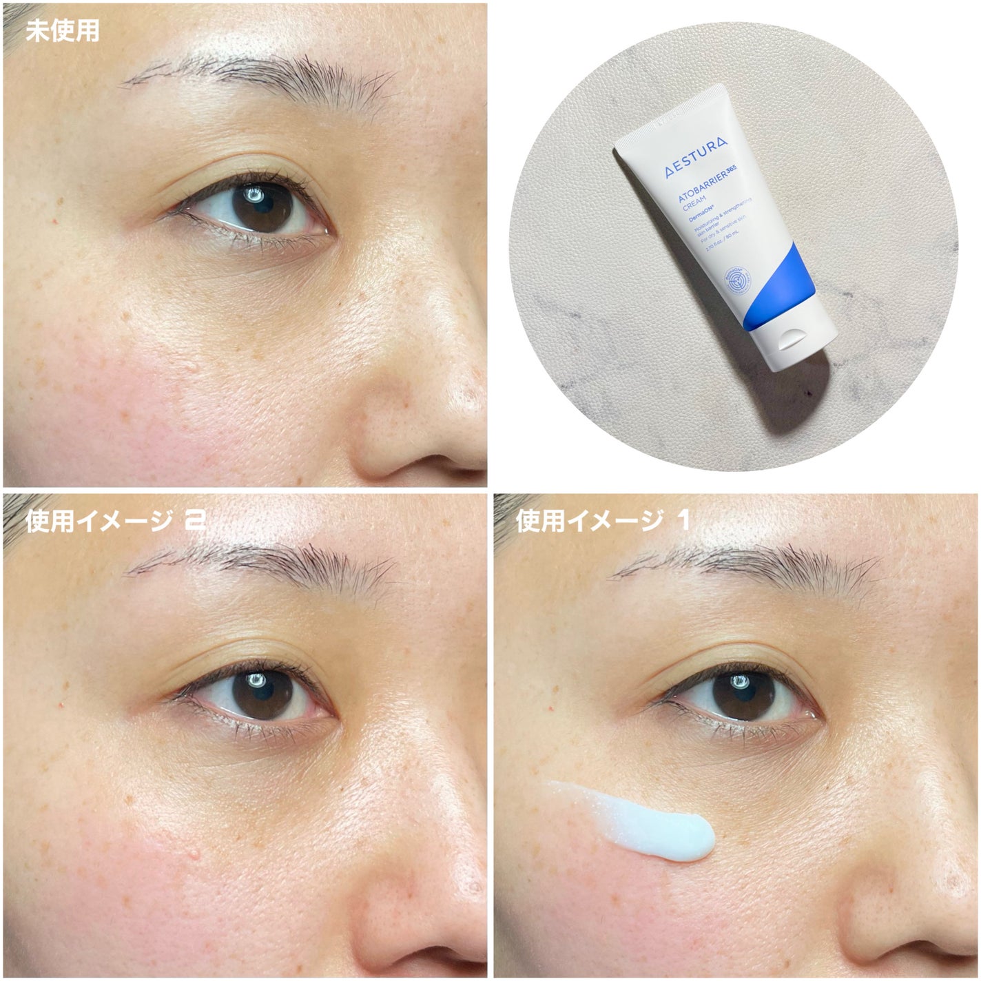 アトバリア365クリーム/AESTURA/フェイスクリームを使ったクチコミ(9枚目)