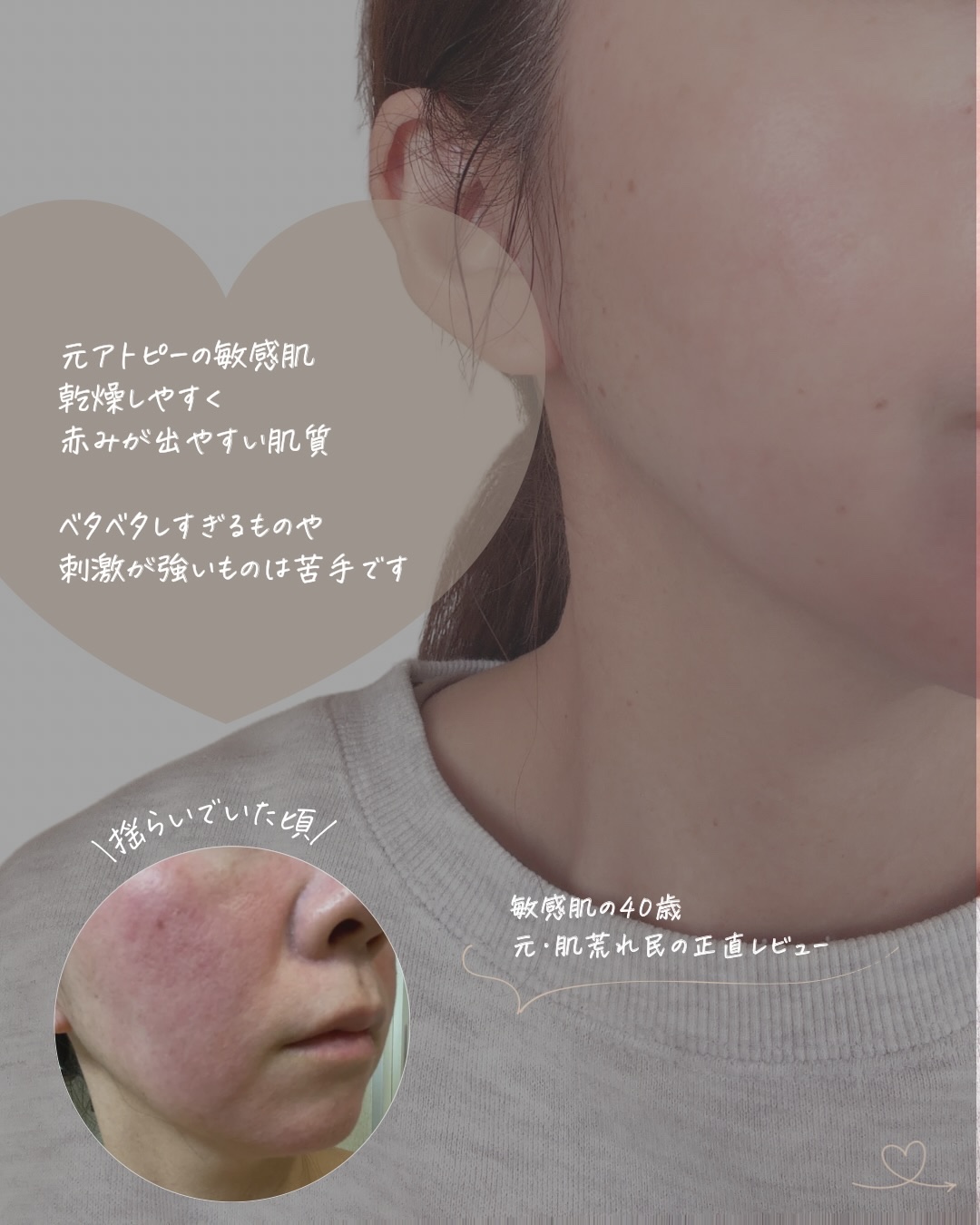 潤浸保湿 泡洗顔料/キュレル/泡洗顔を使ったクチコミ（2枚目）