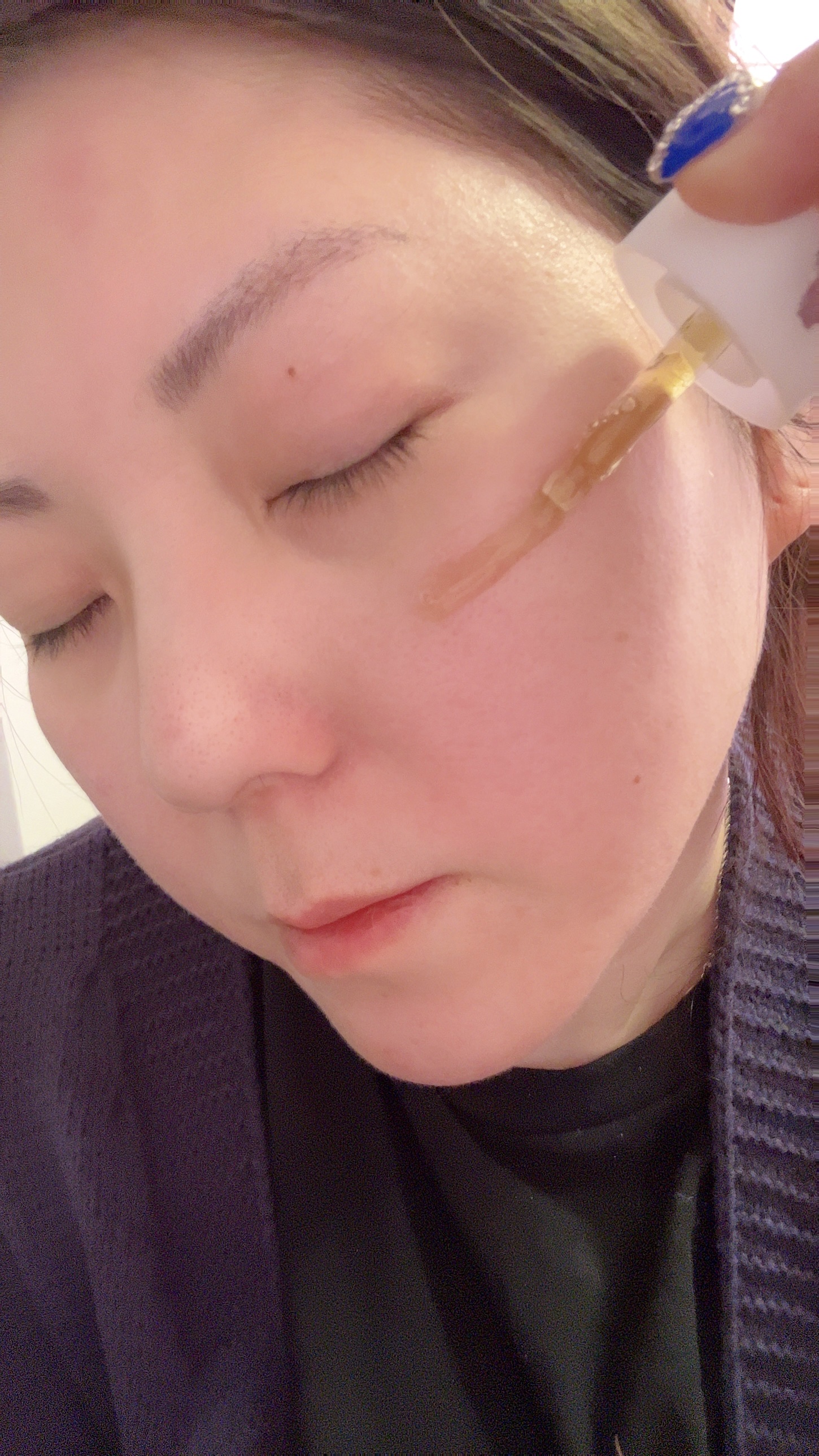 スキンRPセラム/Lowlize/美容液を使ったクチコミ（3枚目）