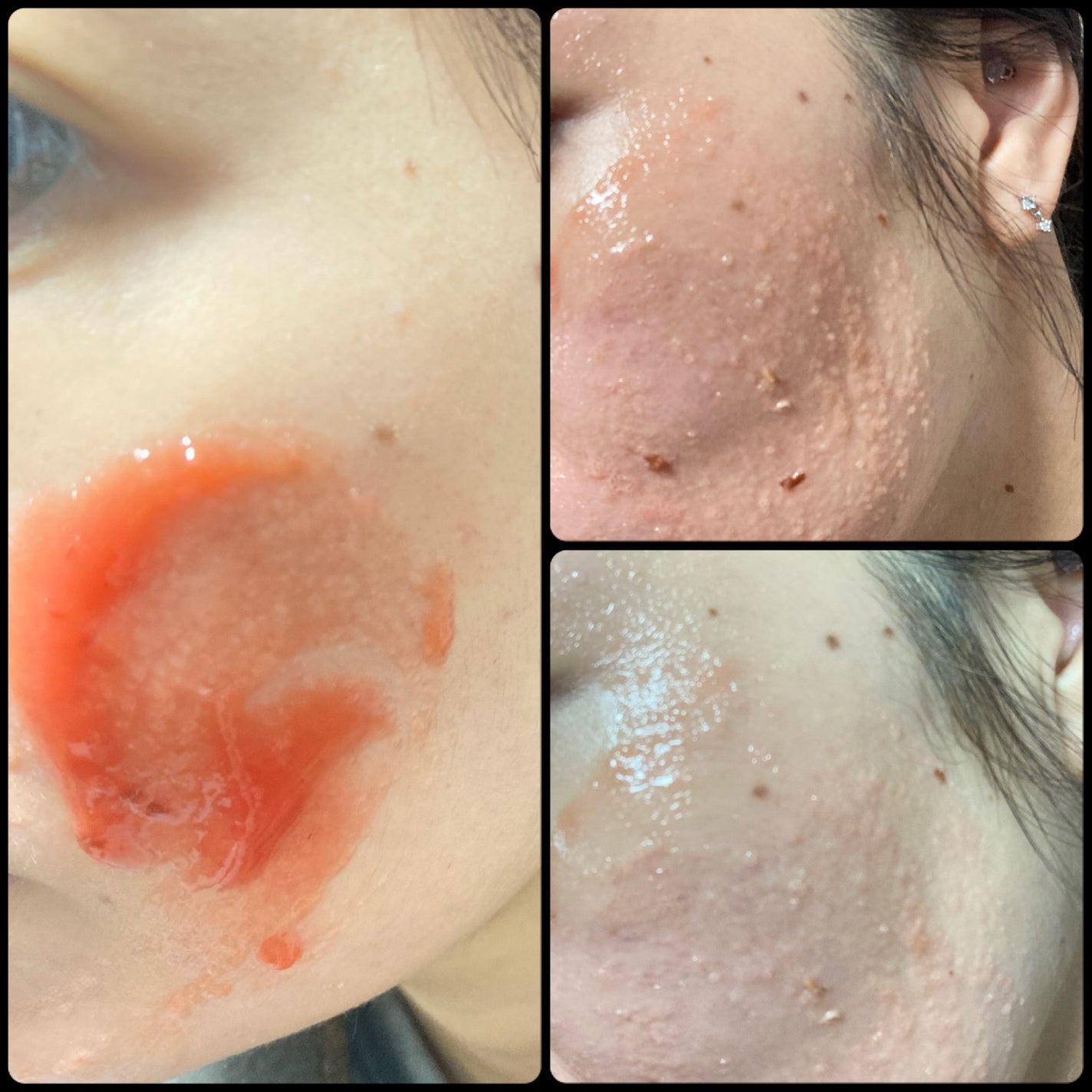 レッドトマトジャムマスククレンザー/FULLY/その他洗顔料を使ったクチコミ(3枚目)