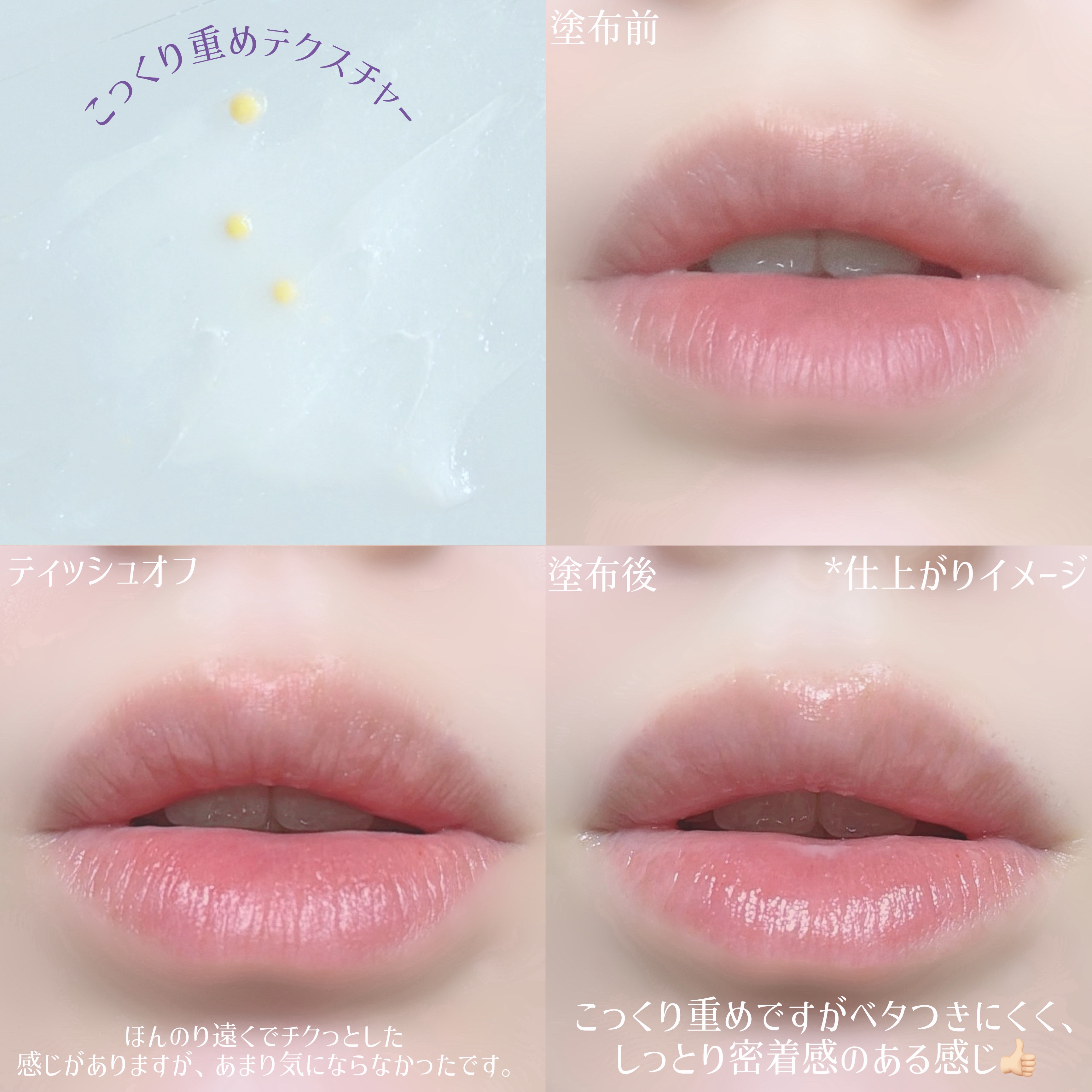 ナイトニードルリップ　ディープモイスト/CHOOSY/リップ美容液を使ったクチコミ（3枚目）