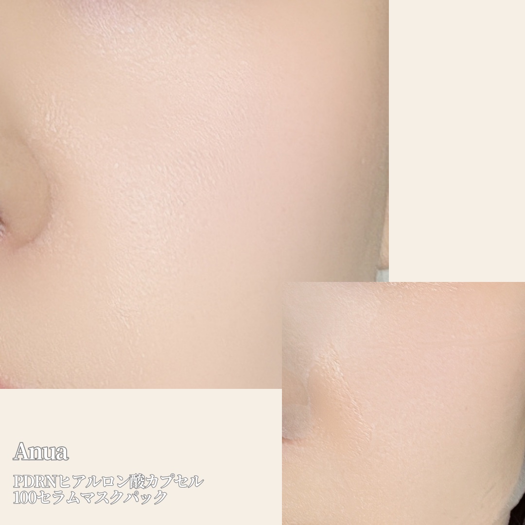 PDRNヒアルロン酸カプセル100セラムマスクパック/Anua/シートマスク・パックを使ったクチコミ（2枚目）