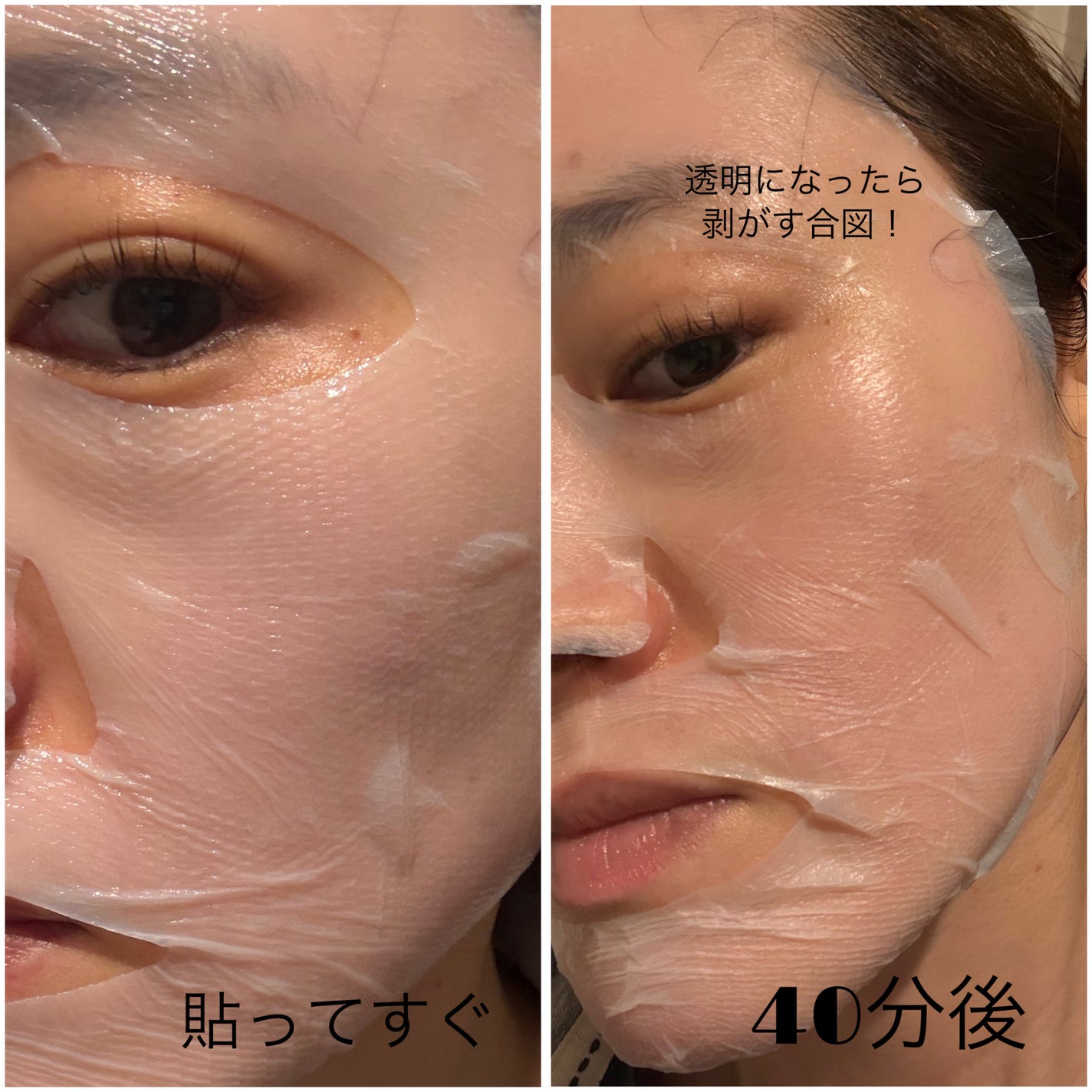 トラブルパッチマスク/EIOM/その他スキンケアを使ったクチコミ(5枚目)