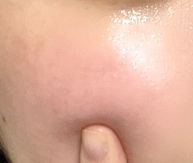 シカレチA マスク/VT/シートマスク・パックを使ったクチコミ（2枚目）