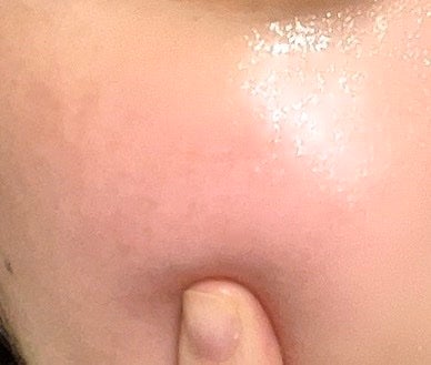 シカレチA マスク/VT/シートマスク・パックを使ったクチコミ(2枚目)