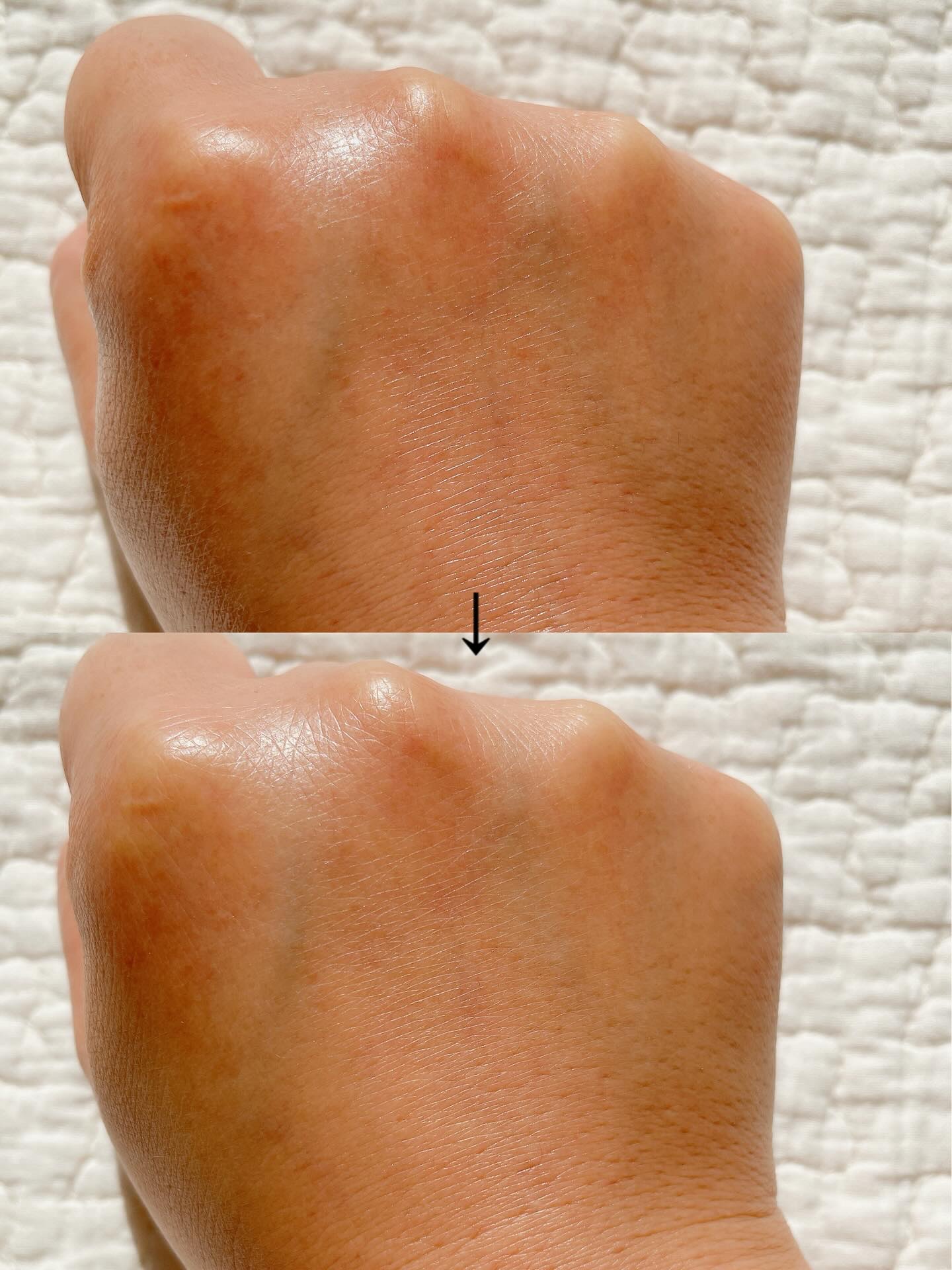 トリプル レチノール ウォッシュピール/Celladix/ピーリングを使ったクチコミ（3枚目）