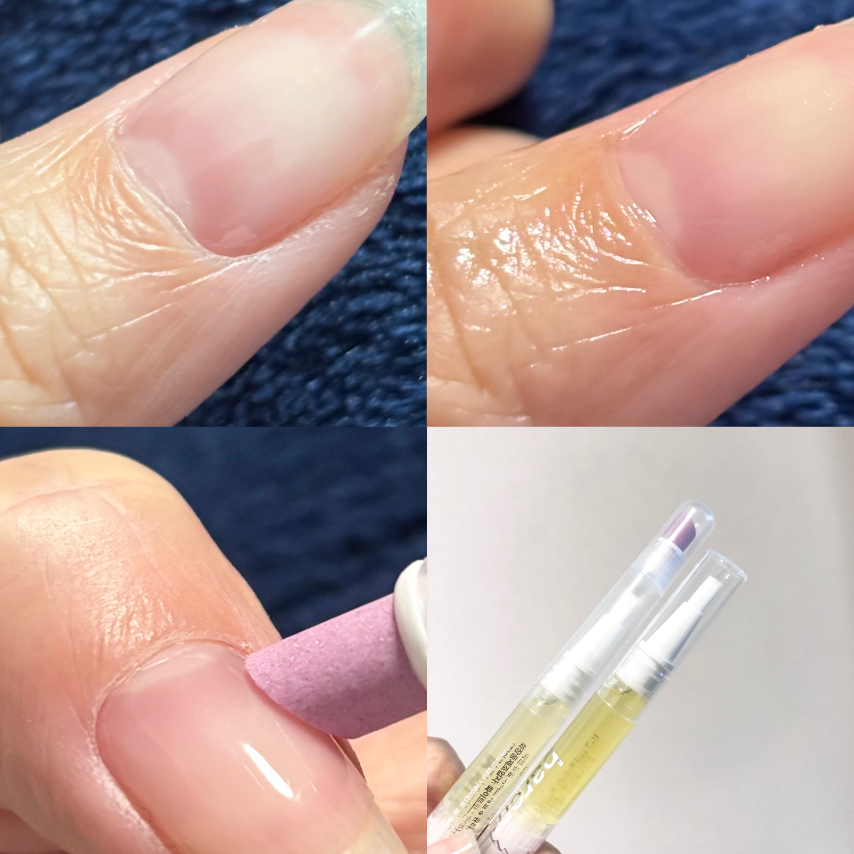 BAREN ネイル＆キューティクルケアエッセンスオイルペンのクチコミ「BAREN

💜ネイル&キューティクルケアエッセンスオイルペン

爪の乾燥･縦ジワ･二枚爪の予.....」（2枚目）