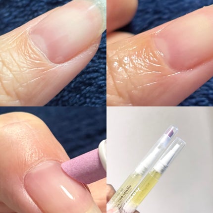 BAREN ネイル&キューティクルケアエッセンスオイルペンのクチコミ「BAREN
💜ネイル&キューティクルケアエッセンスオイルペン
爪の乾燥・縦ジワ・二枚爪の予.....」(2枚目)