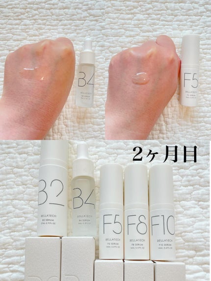 スキンスキャナー/BELLATECH/その他スキンケアグッズを使ったクチコミ(2枚目)