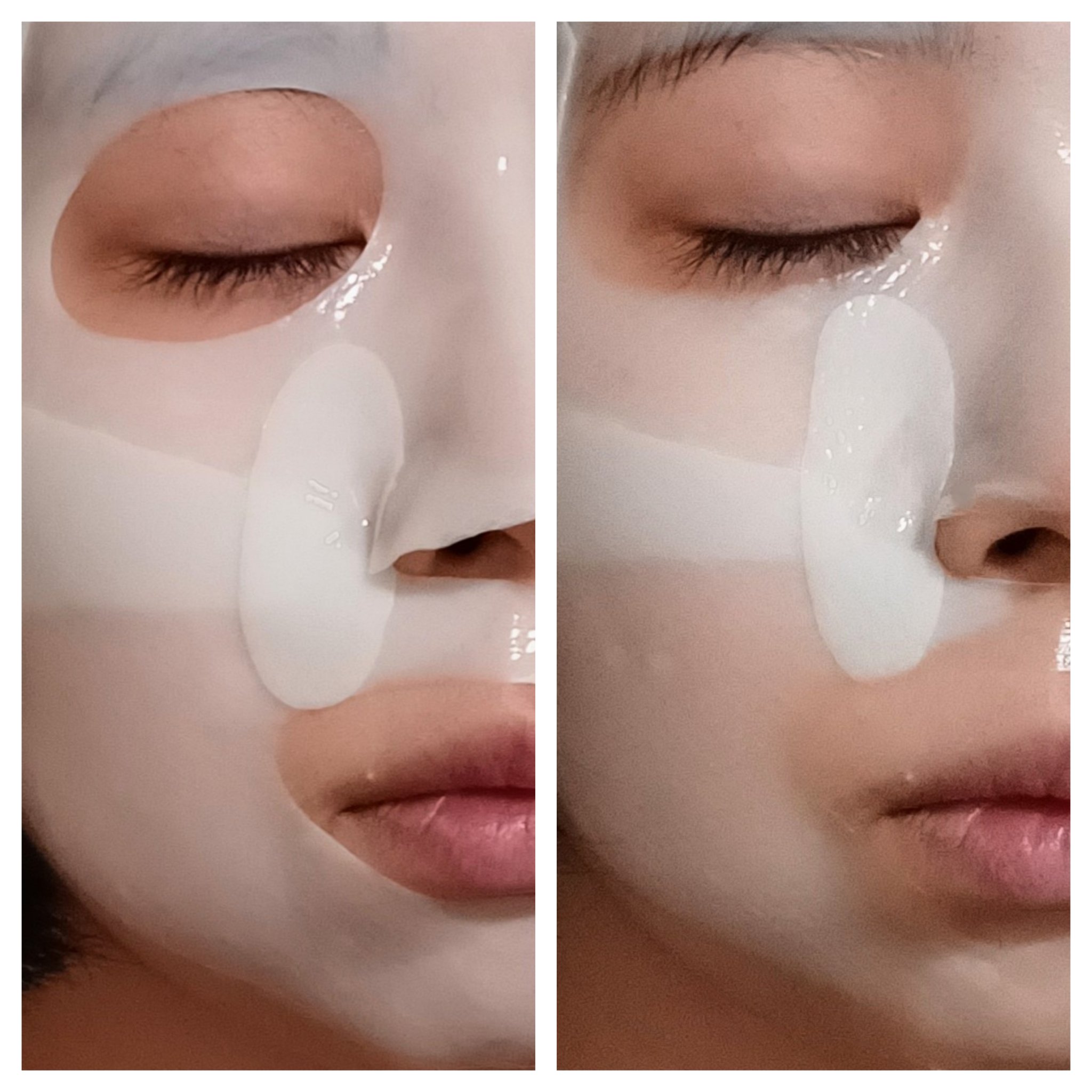 パーフェクト リアル パフォーマンス シカコラーゲンマスクパック /ダーマフィックス/シートマスク・パックを使ったクチコミ（3枚目）