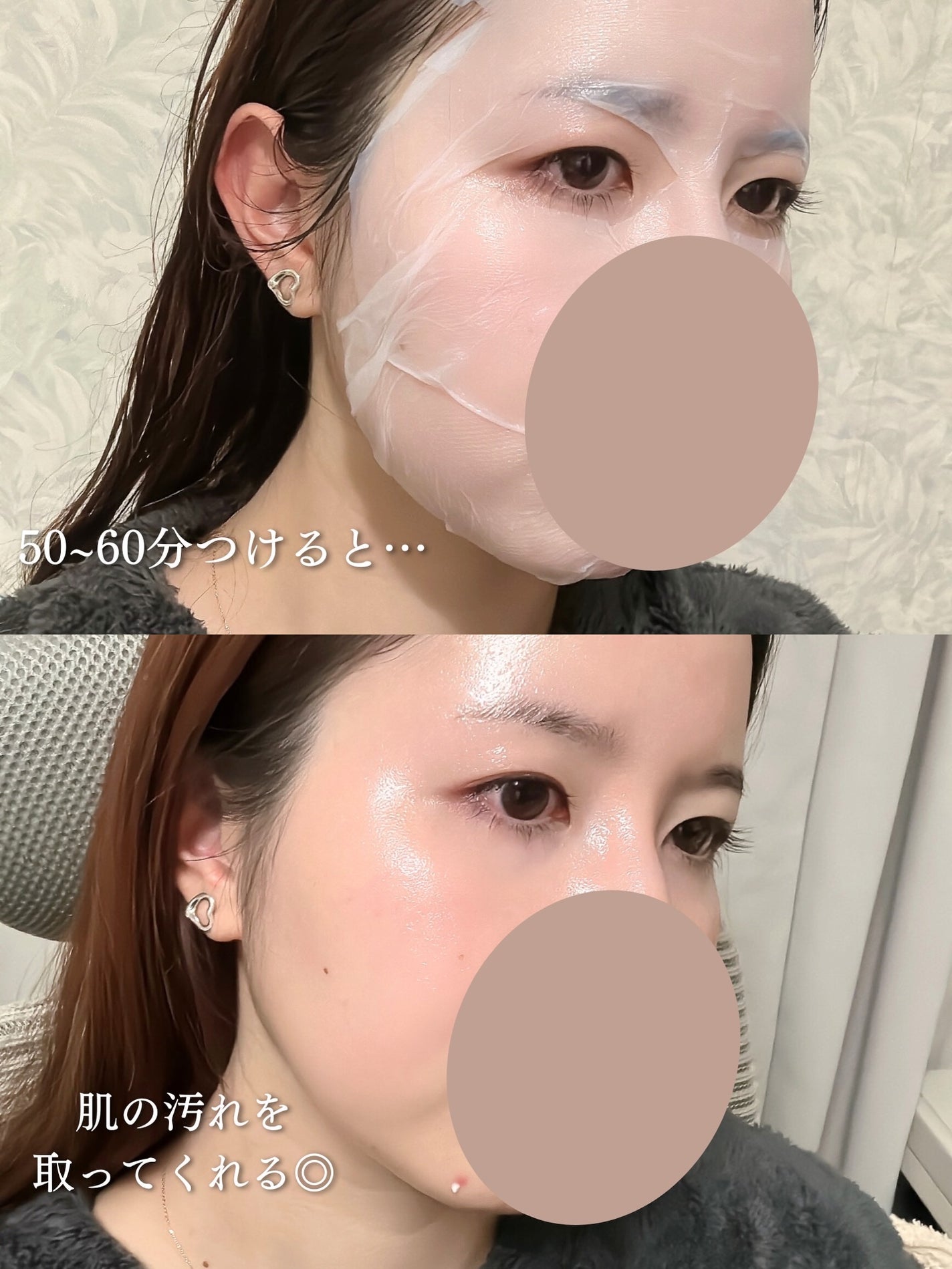 トラブルパッチマスク/EIOM/その他スキンケアを使ったクチコミ(4枚目)