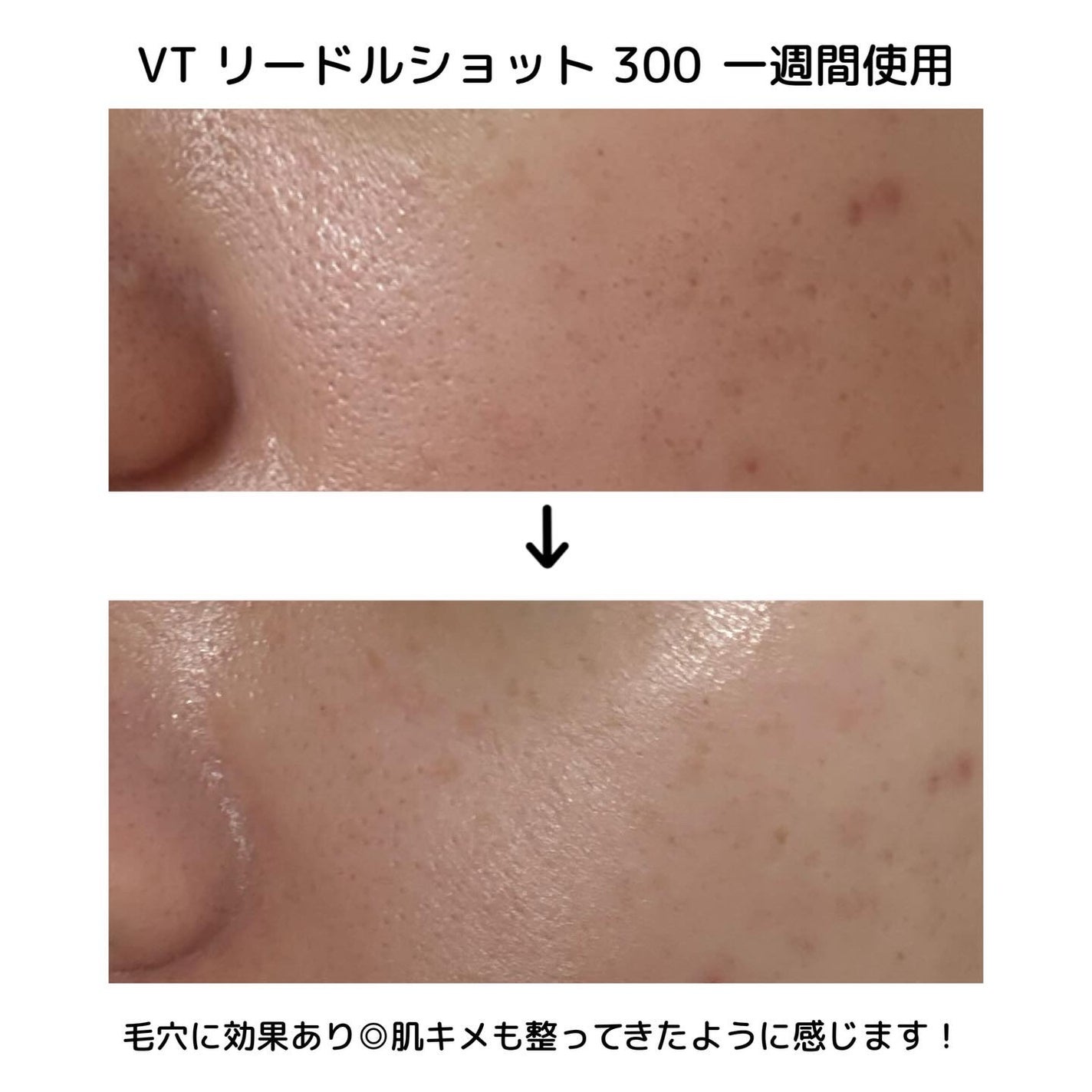 リードルショット100/VT/美容液を使ったクチコミ(4枚目)