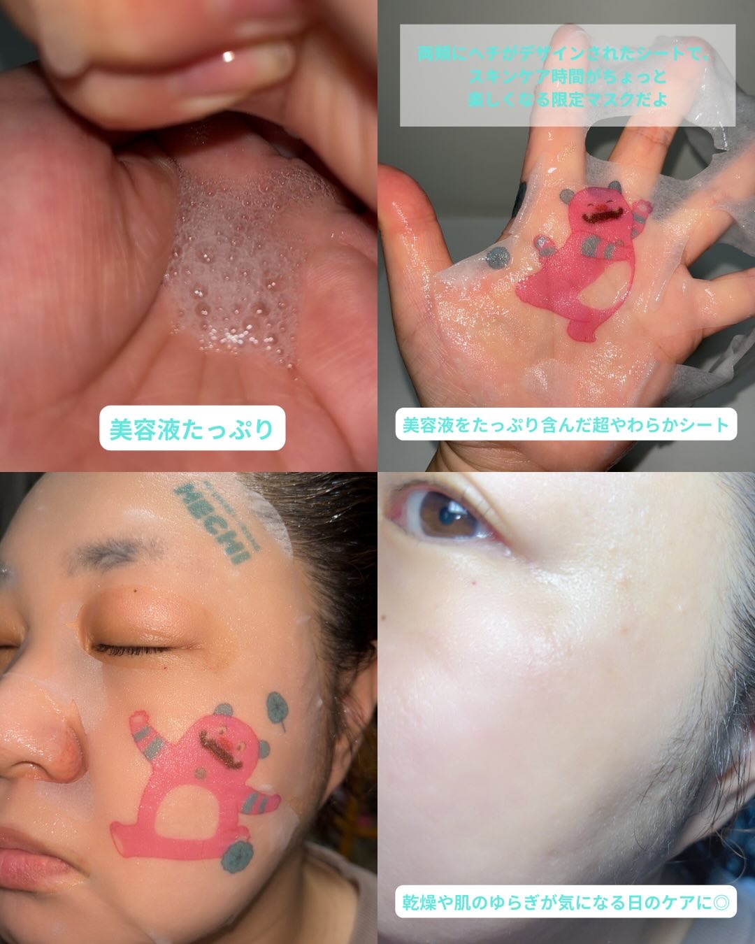 マデカッソシドブレミッシュパッド/MEDIHEAL/トナーパッドを使ったクチコミ（3枚目）