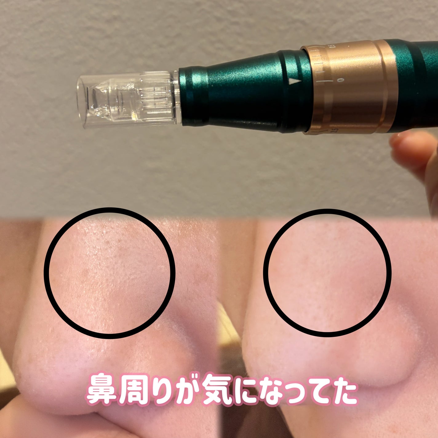 しおりん/相互フォロー/フォロバ100 on LIPS 「#PR最近、毛穴の開きとハリ不足が気になってて取り入れたのがV..」(2枚目)