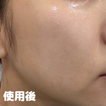 5 PDRN コラーゲン インテンス バイタライジング セラム/COSRX/美容液を使ったクチコミ(5枚目)