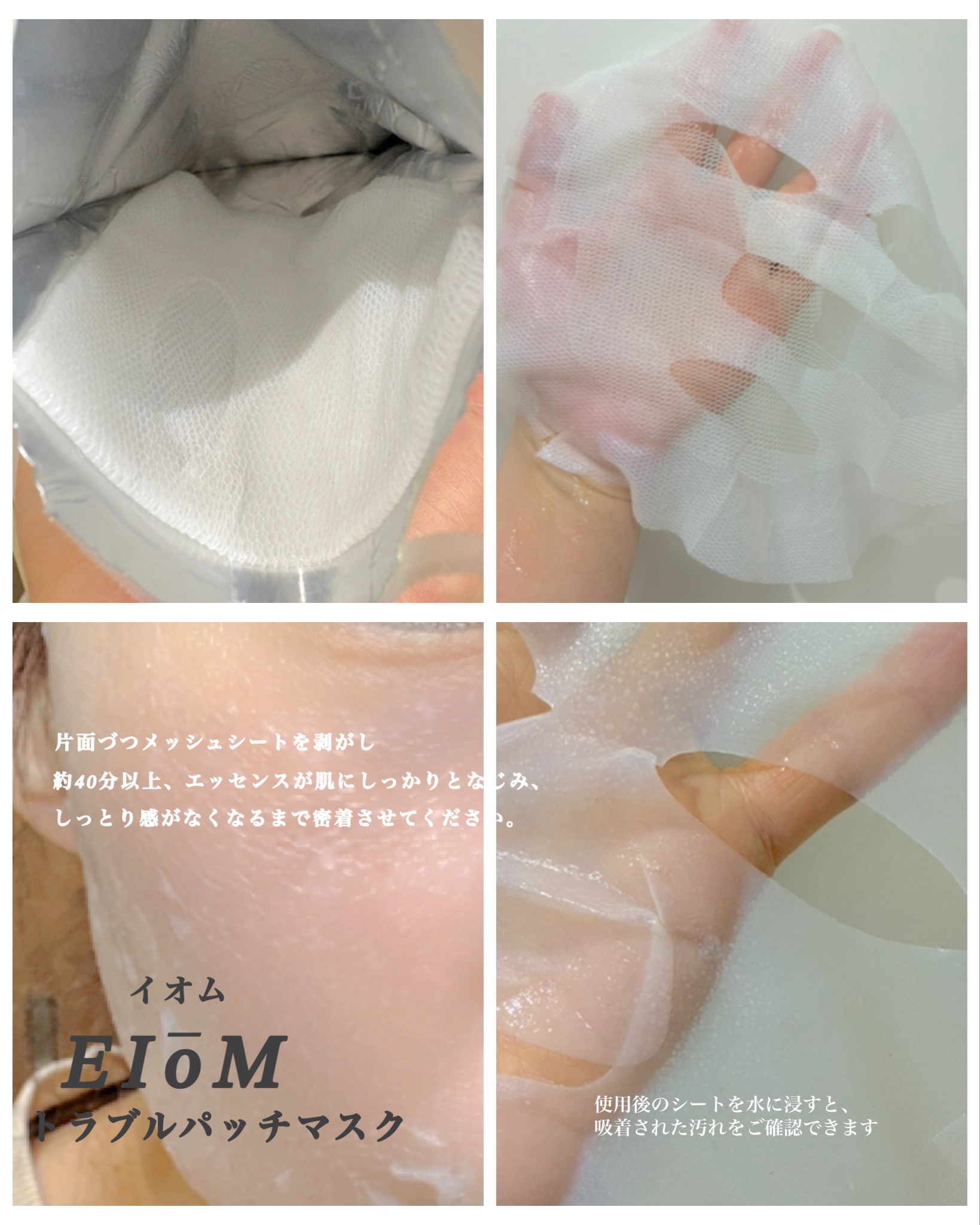 トラブルパッチマスク/EIOM/その他スキンケアを使ったクチコミ（3枚目）